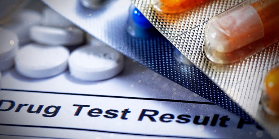 Werden Zauberpilze Und -Trüffel Bei Einem Drogentest Angezeigt?