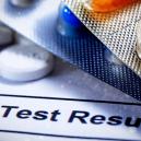 Werden Zauberpilze Und -Trüffel Bei Einem Drogentest Angezeigt?